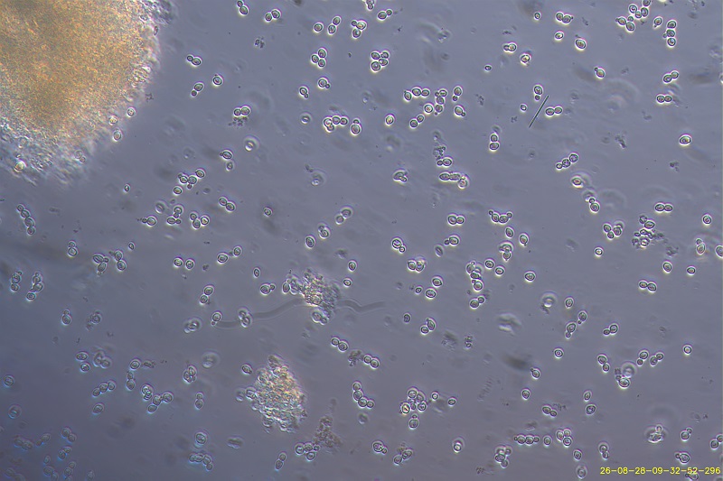 Observation au microscope d'un levain naturel et des levures Saccharomyces responsables de la fermentation du vin.